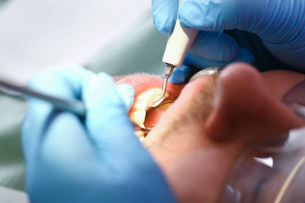 Best After-Hours Emergency Dentist in South Zanesville, OH